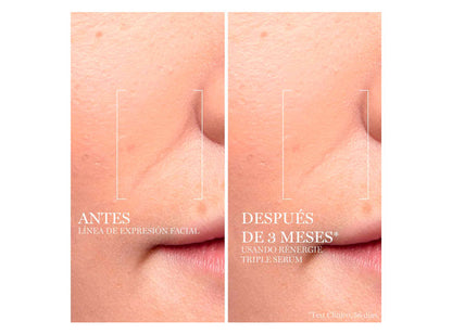 Serum Antiedad Triple Rénergie Multi-Lift 50 Ml